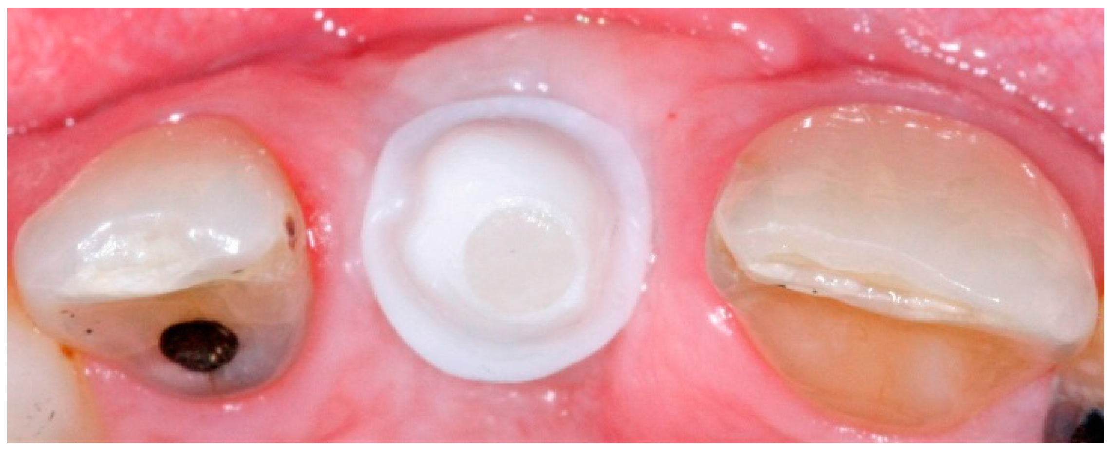 Dentistry 04 00014 g005