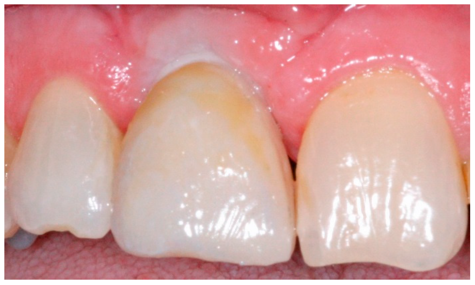 Dentistry 04 00014 g007