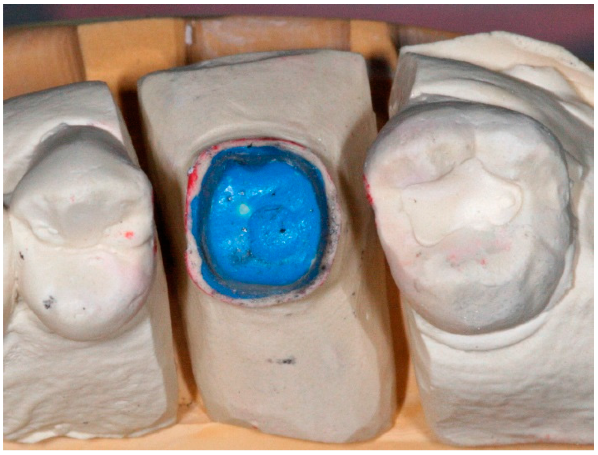 Dentistry 04 00014 g010