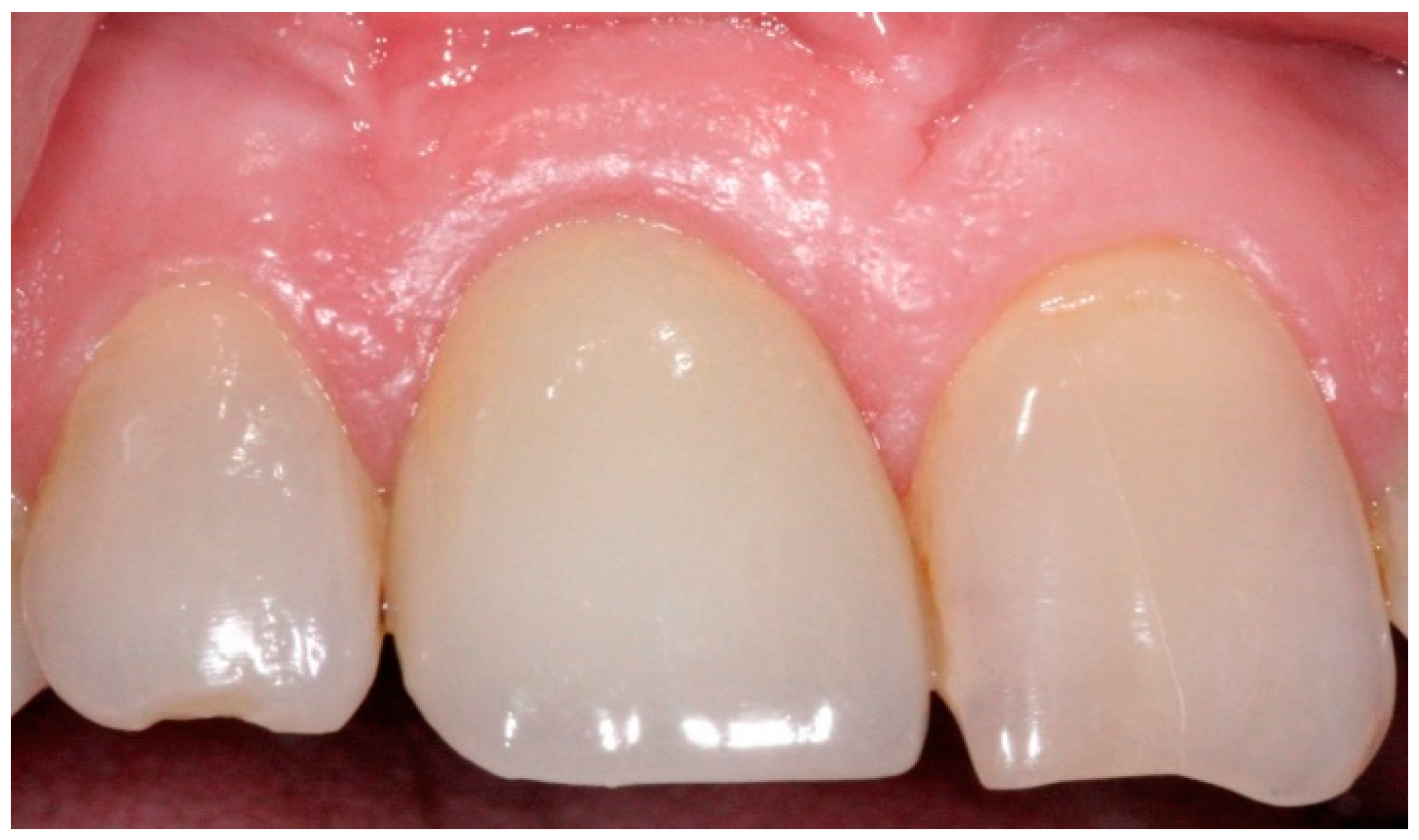 Dentistry 04 00014 g011