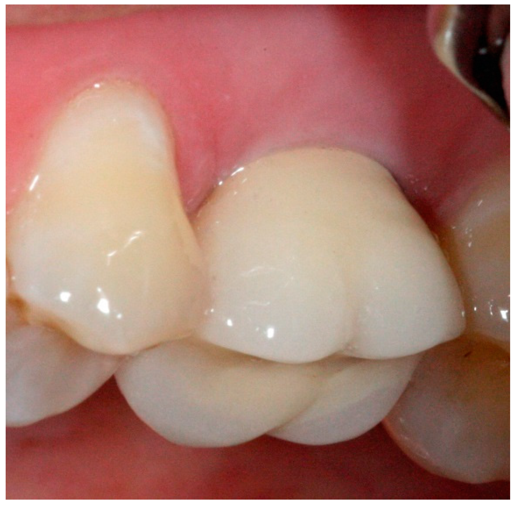 Dentistry 04 00014 g012