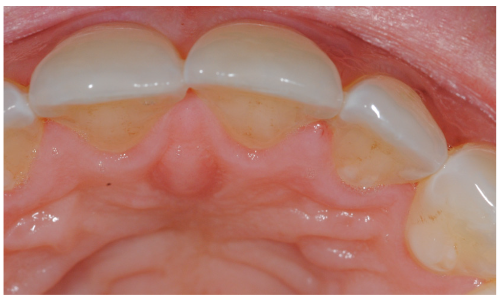 Dentistry 04 00022 g002 1024