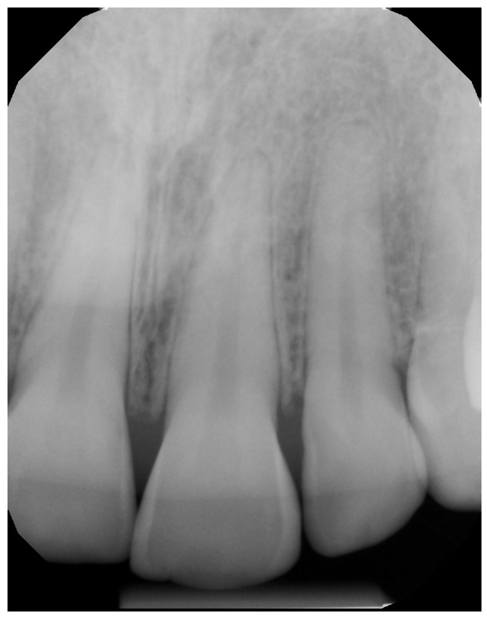 Dentistry 04 00022 g003