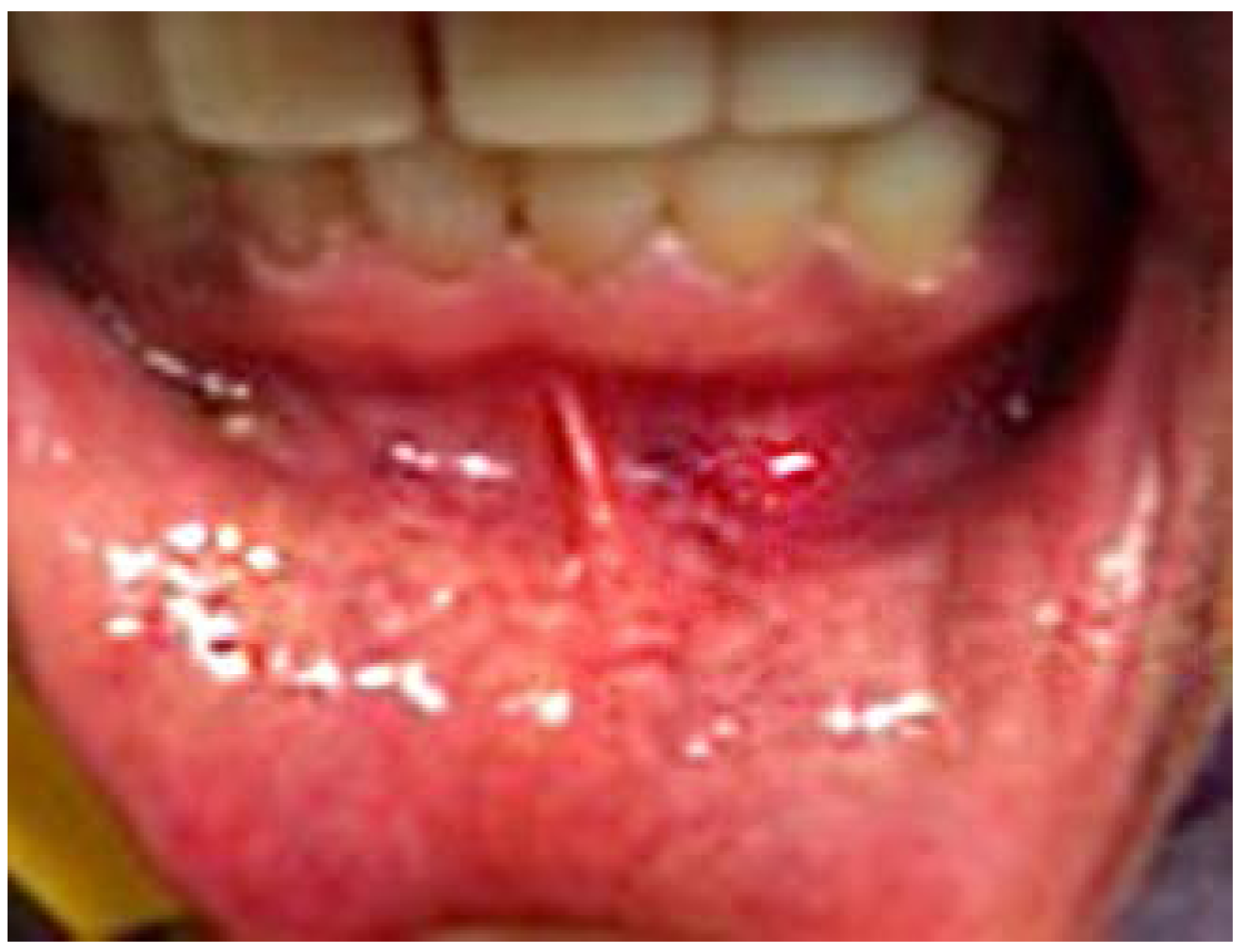 Dentistry 05 00010 g002