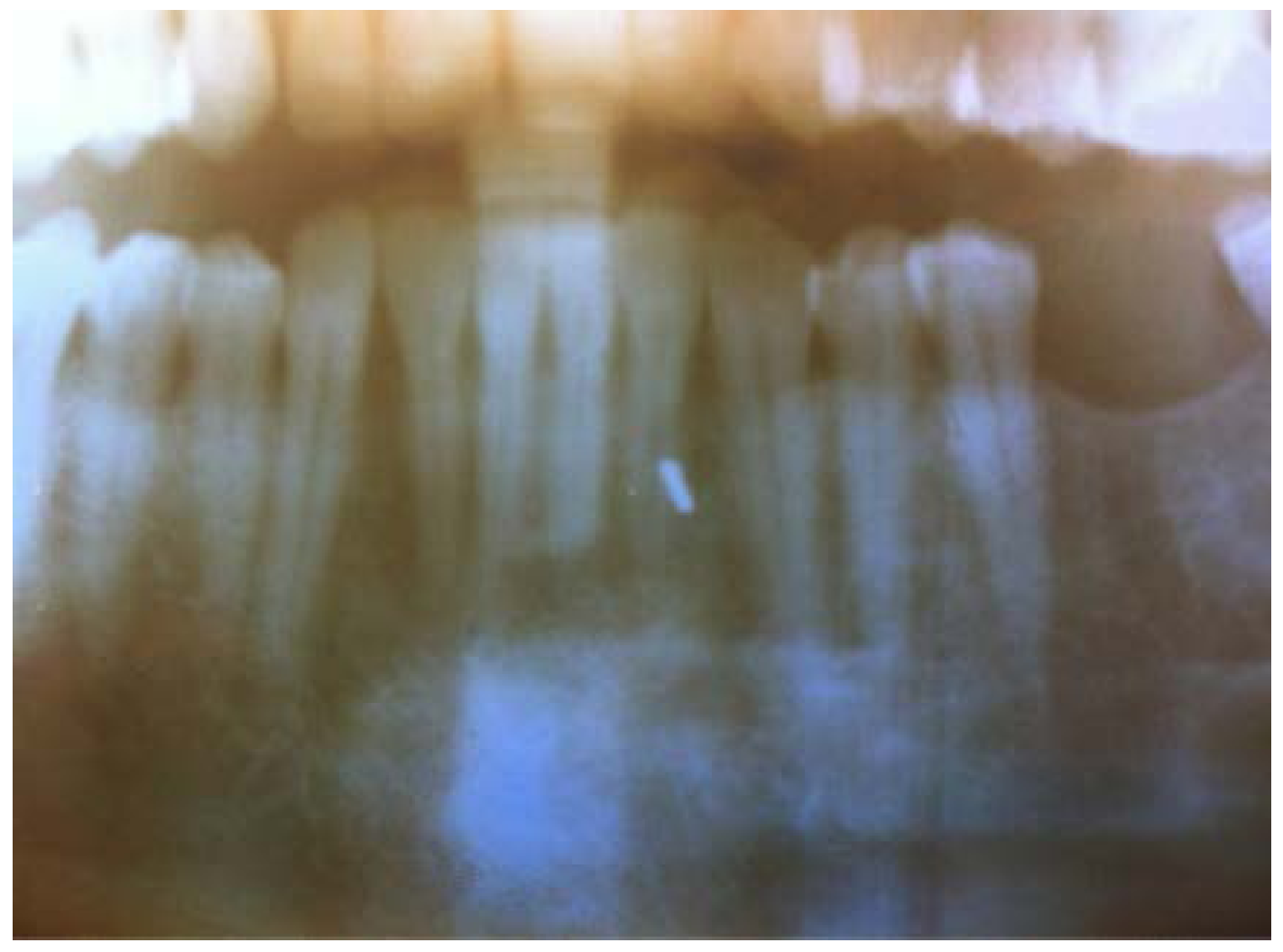 Dentistry 05 00010 g003