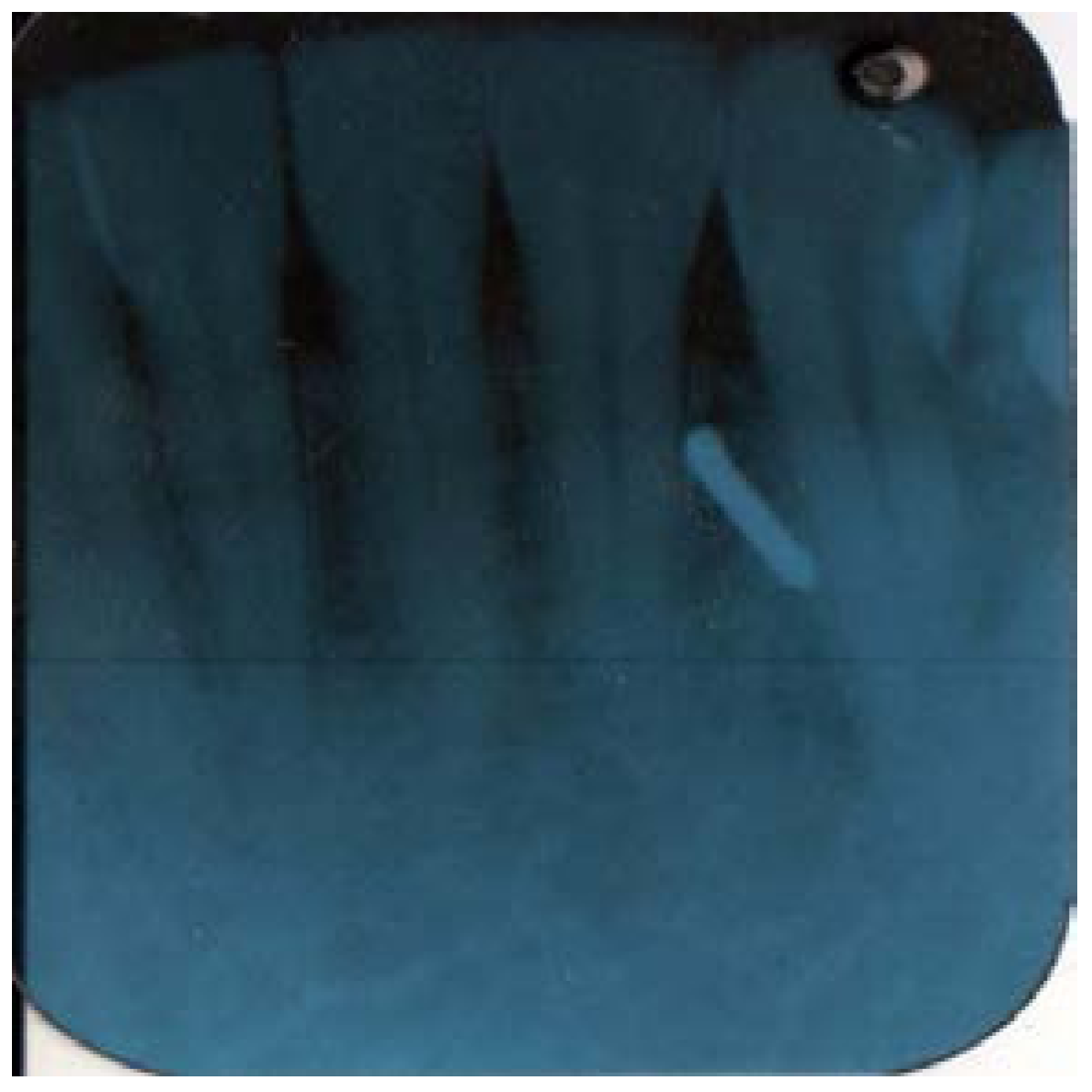 Dentistry 05 00010 g004