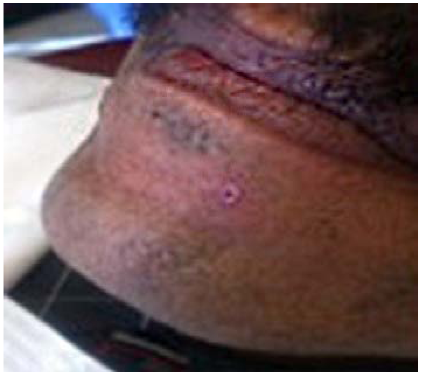 Dentistry 05 00010 g005