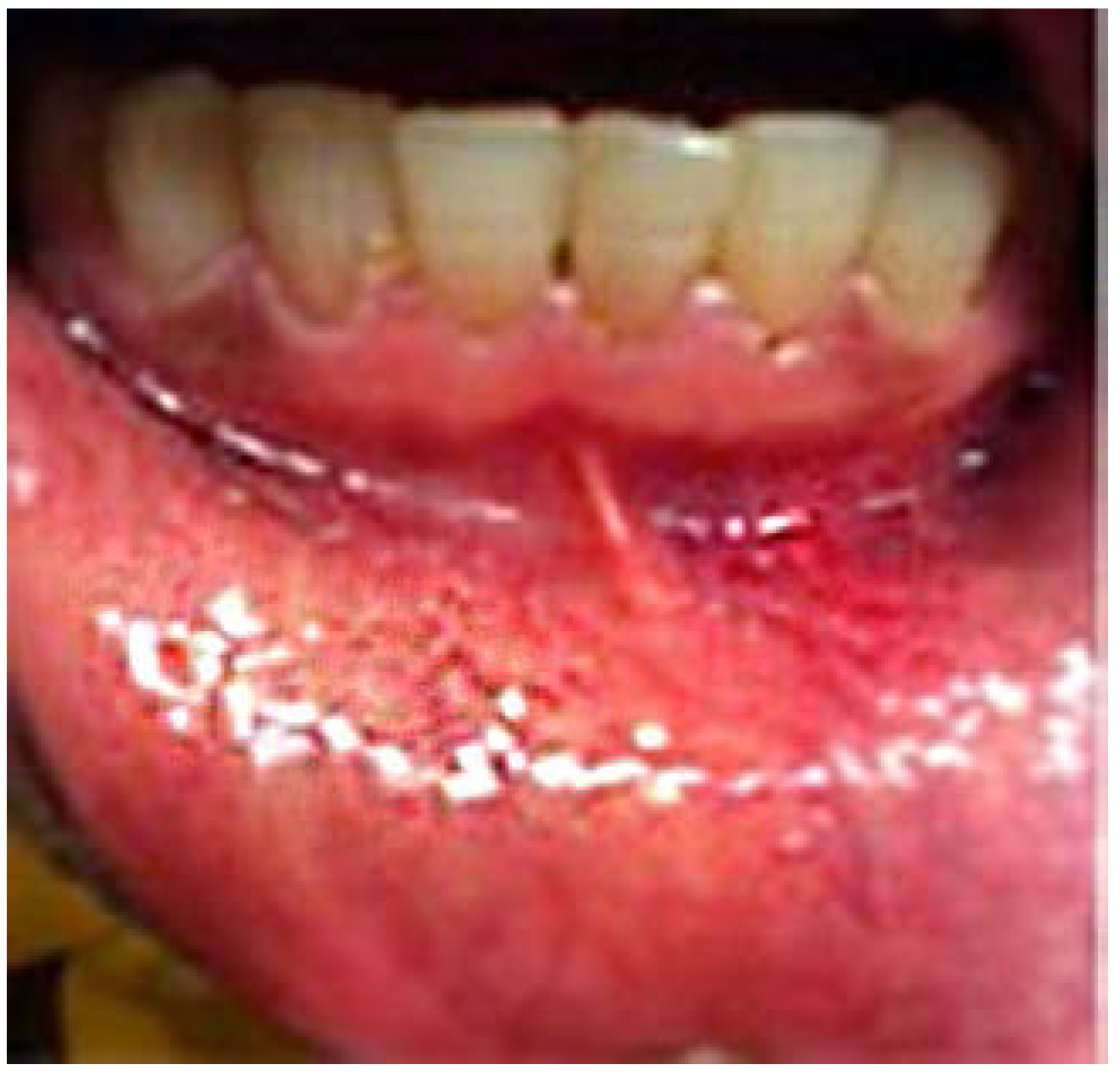 Dentistry 05 00010 g006