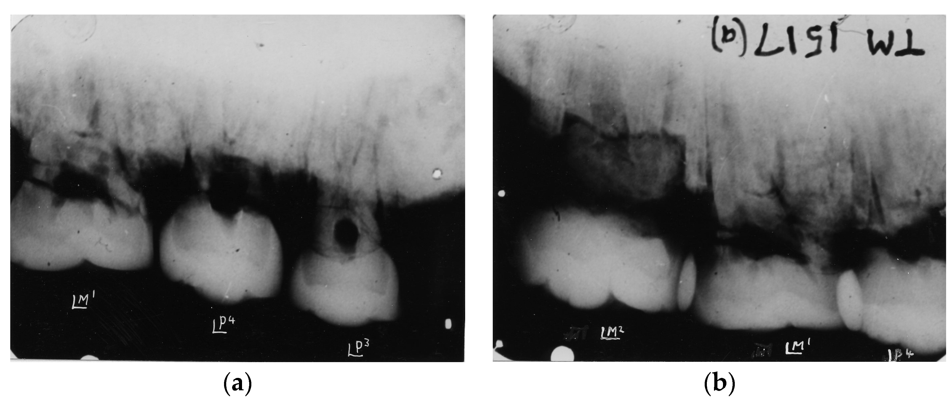 Dentistry 05 00019 g004