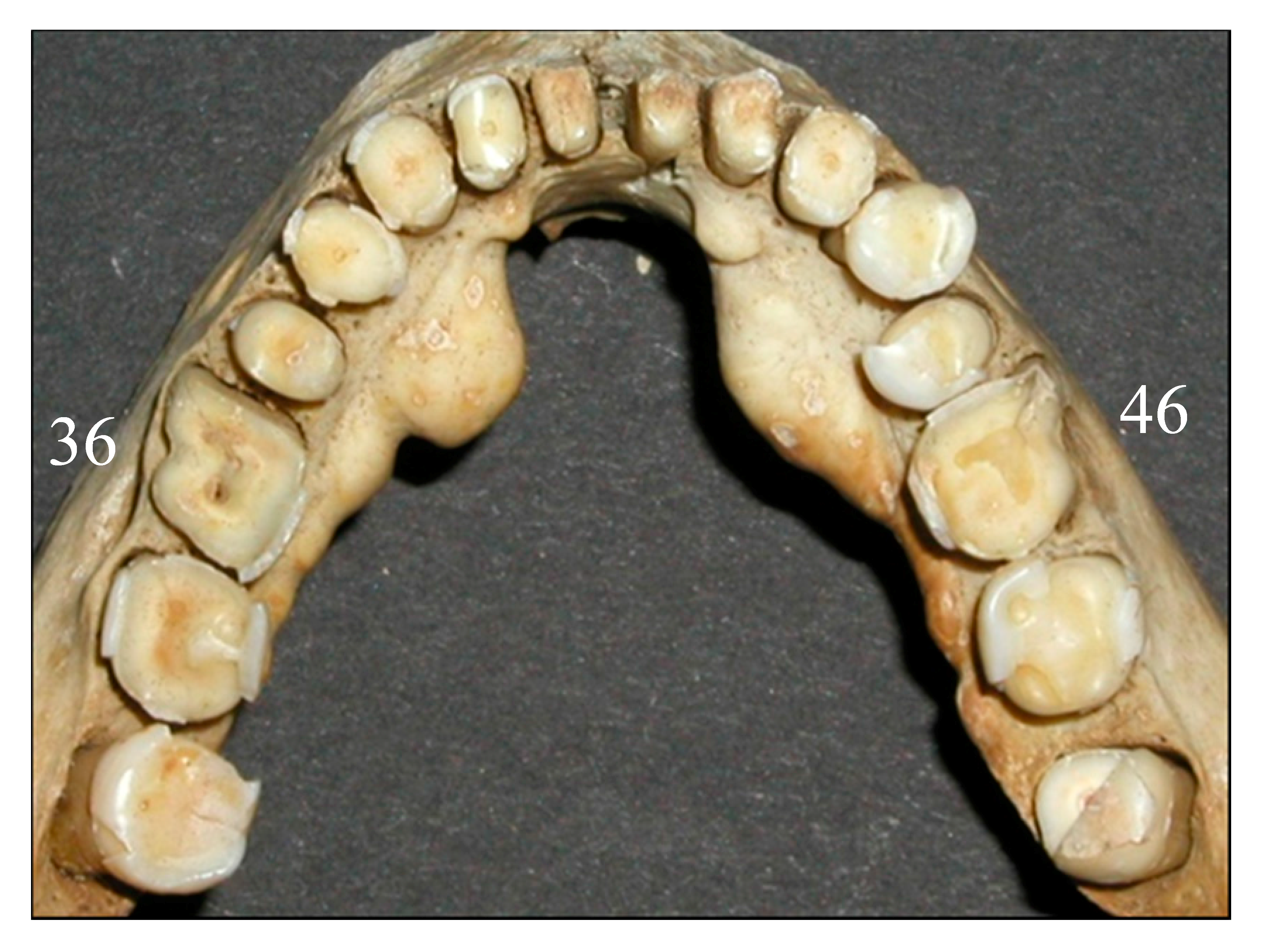 Dentistry 05 00024 g004