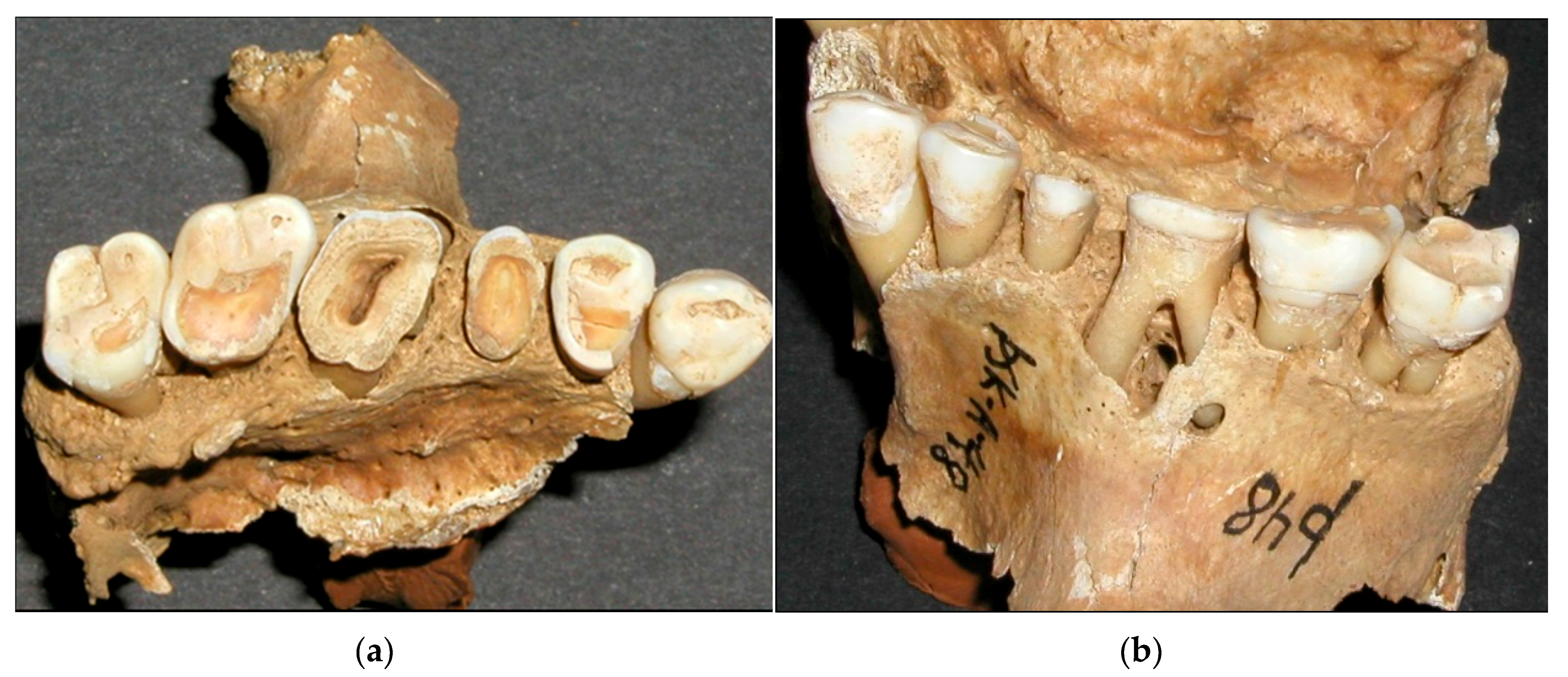 Dentistry 05 00024 g005