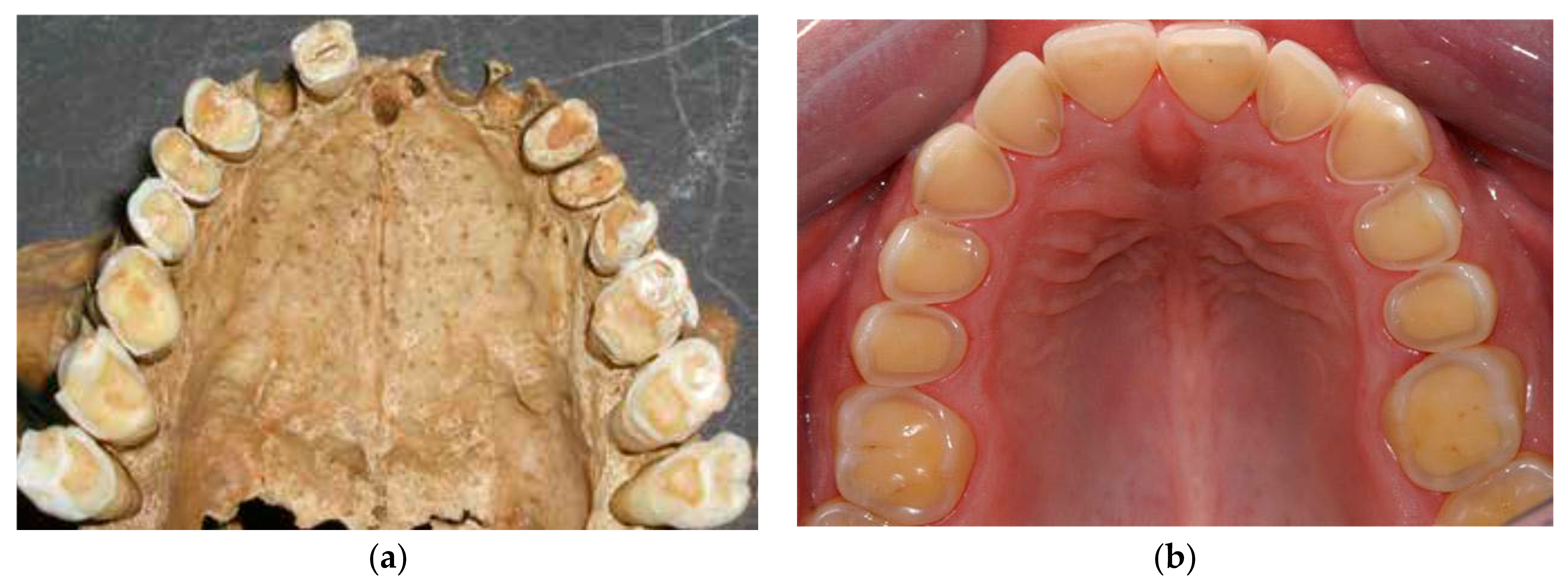 Dentistry 05 00024 g007