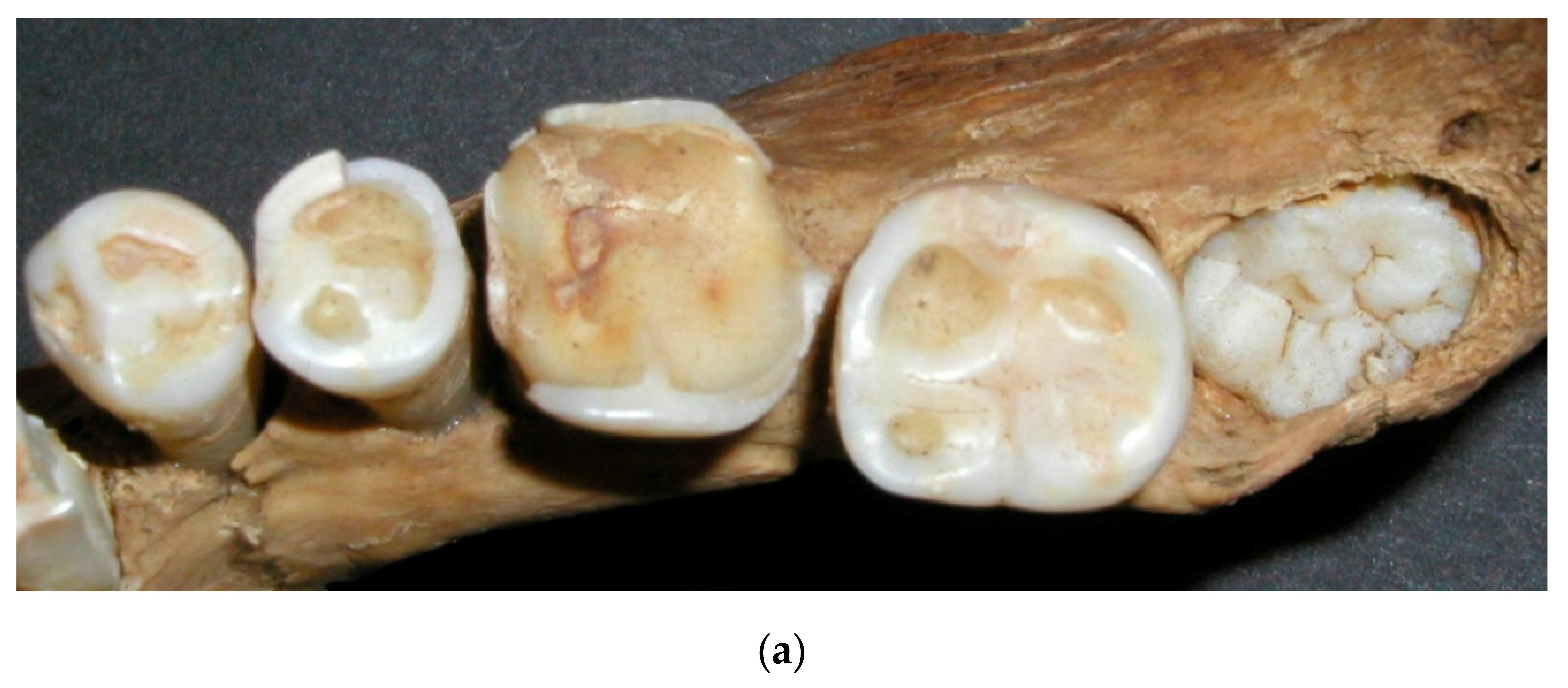 Dentistry 05 00024 g008a