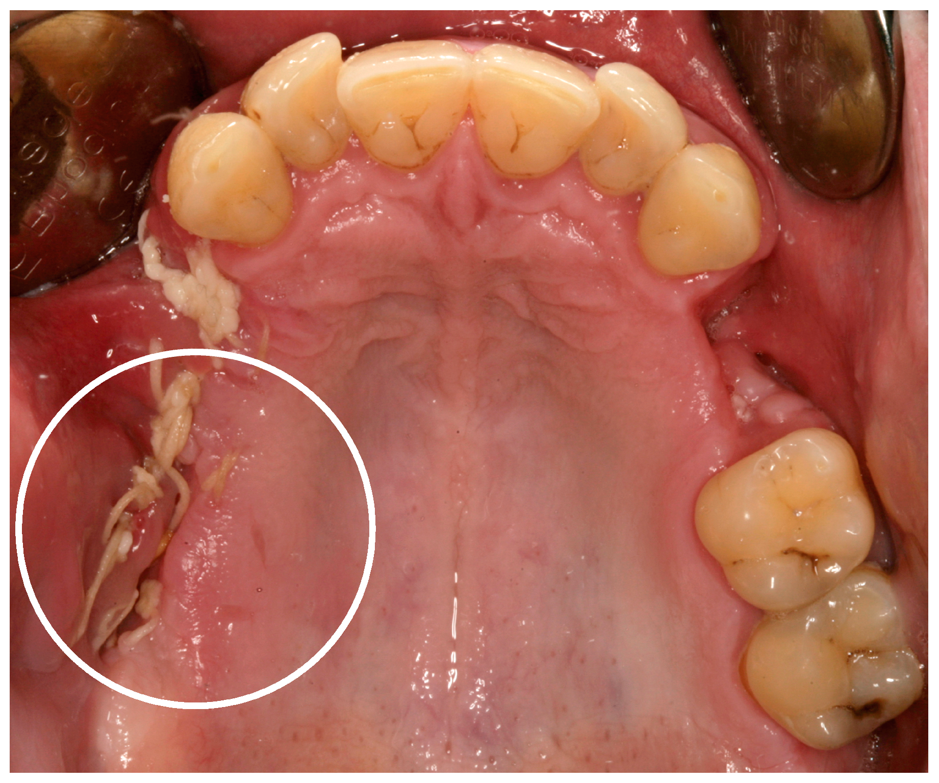 Dentistry 05 00029 g002