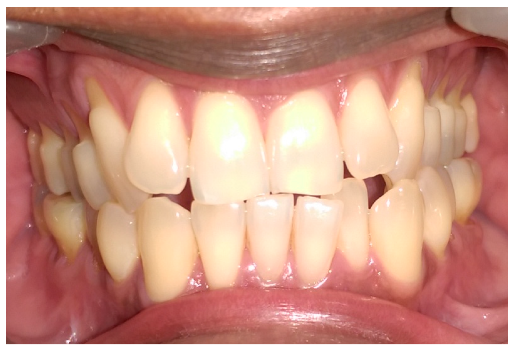 Dentistry 05 00033 g001 Dentistry 05 00033 g001