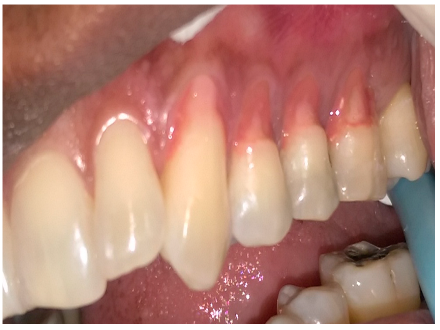 Dentistry 05 00033 g002 Dentistry 05 00033 g002