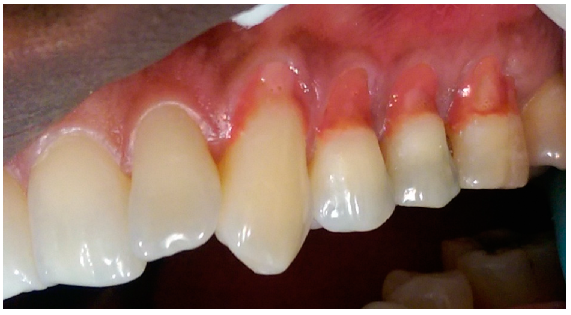 Dentistry 05 00033 g003 Dentistry 05 00033 g003