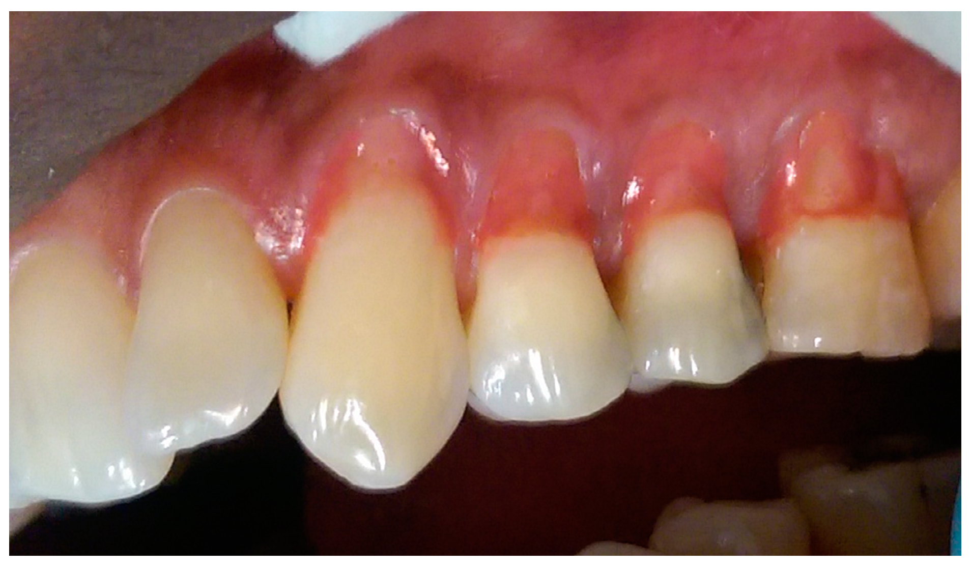 Dentistry 05 00033 g004 Dentistry 05 00033 g004