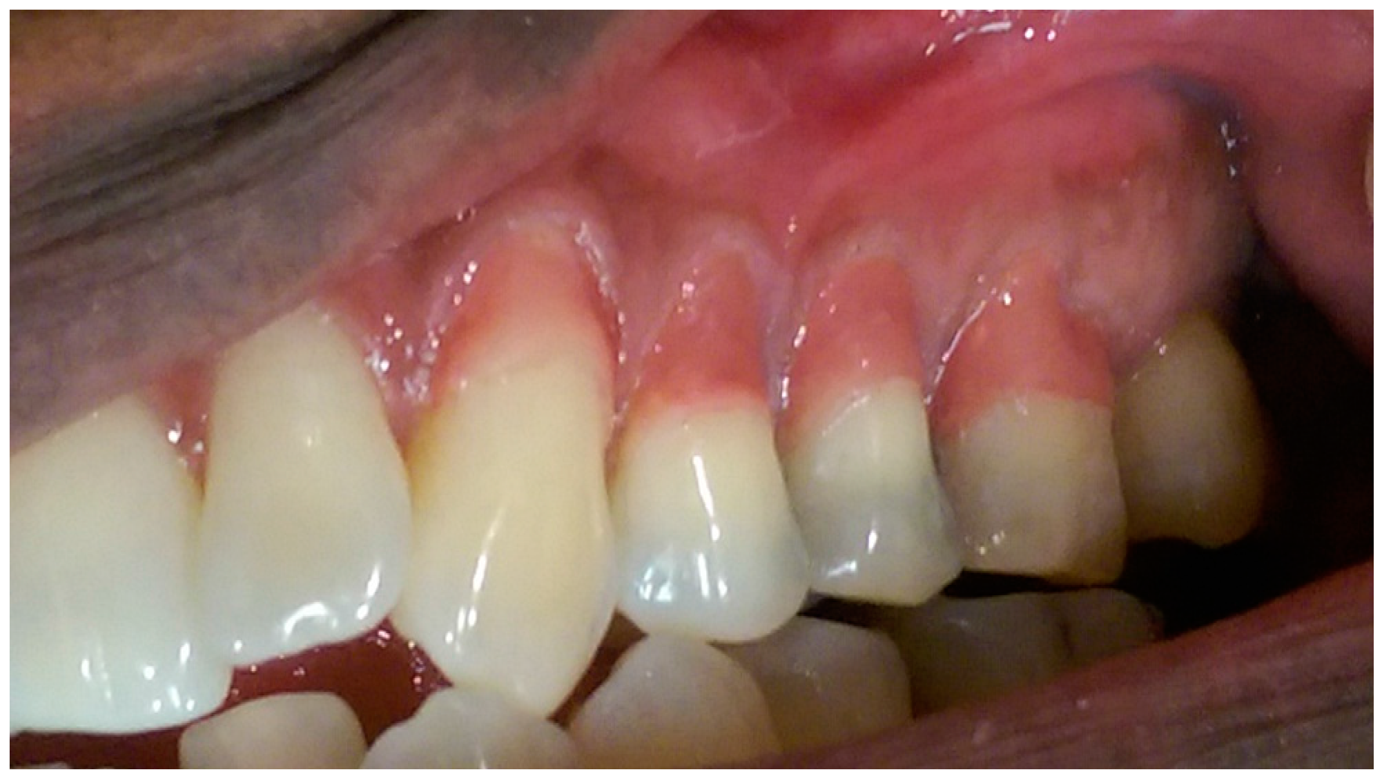 Dentistry 05 00033 g005 Dentistry 05 00033 g005