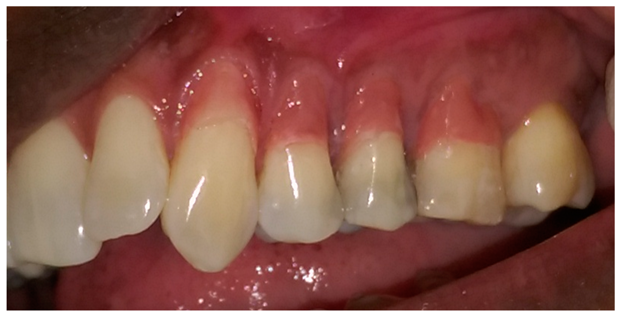Dentistry 05 00033 g006 Dentistry 05 00033 g006