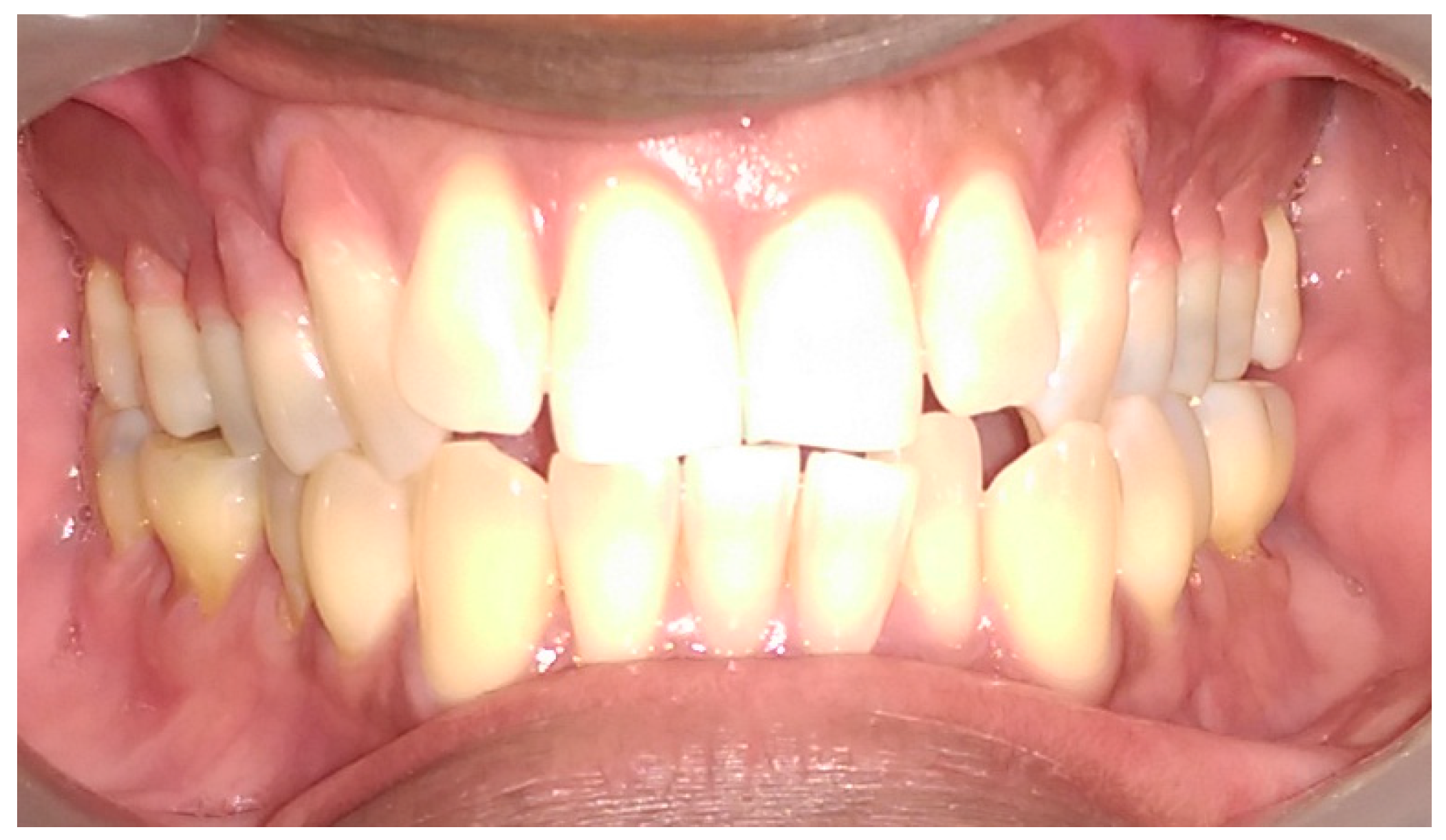 Dentistry 05 00033 g007 Dentistry 05 00033 g007