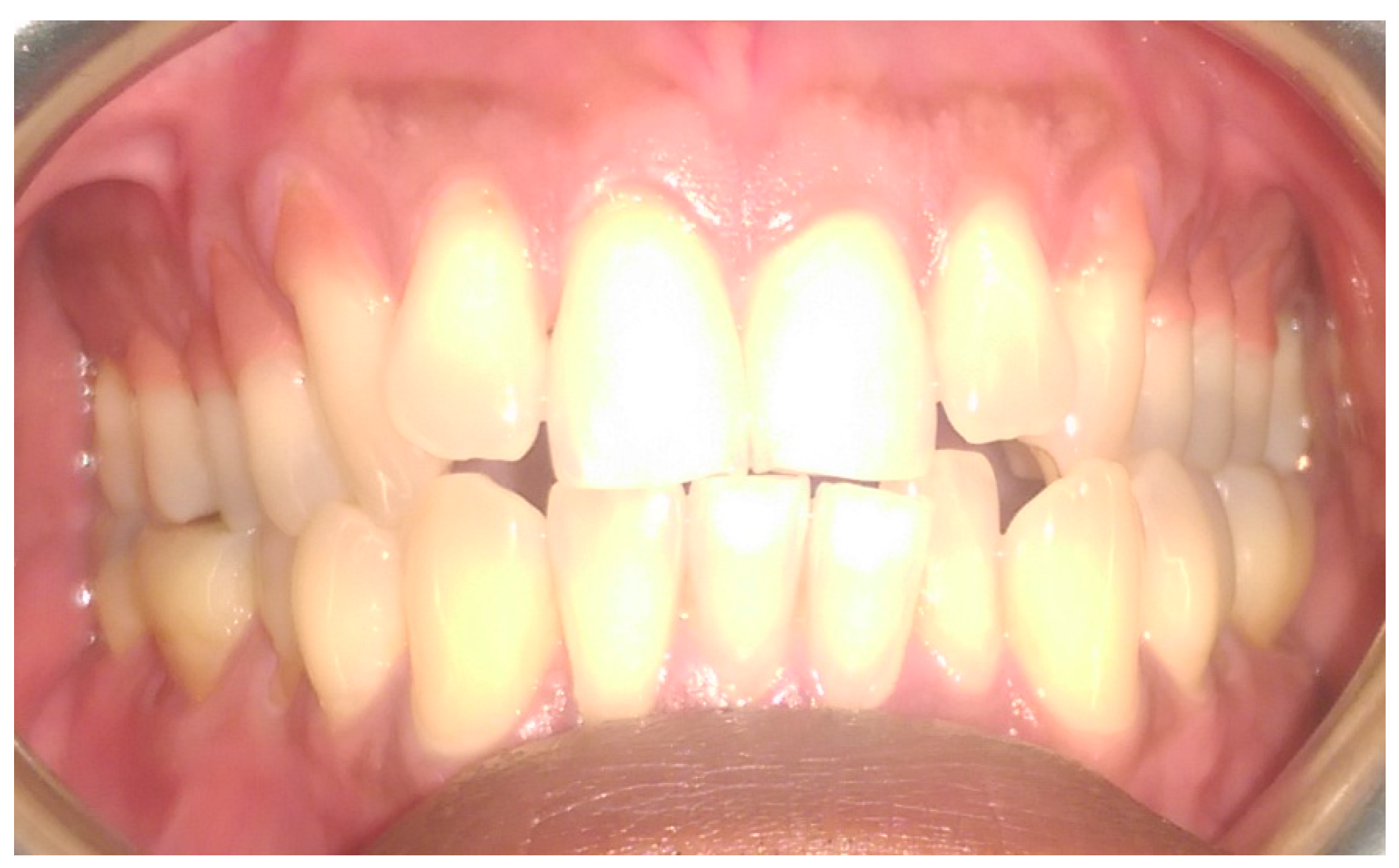 Dentistry 05 00033 g008 Dentistry 05 00033 g008