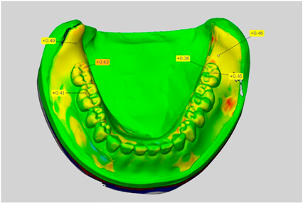 Dentistry 05 00036 i001