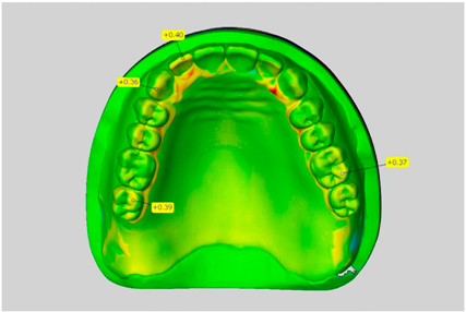 Dentistry 05 00036 i003