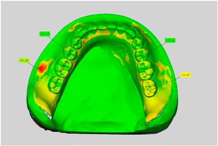 Dentistry 05 00036 i005