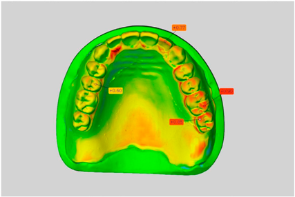 Dentistry 05 00036 i008
