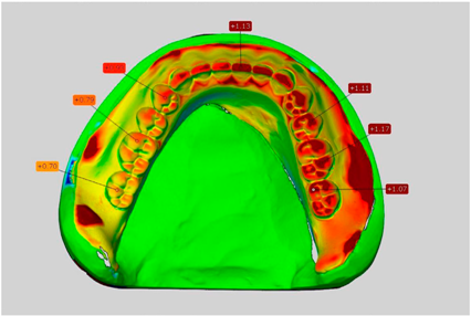 Dentistry 05 00036 i010