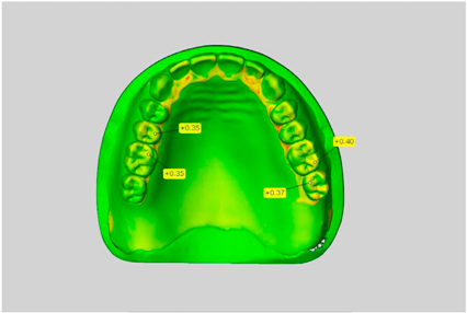 Dentistry 05 00036 i011