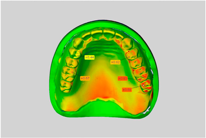Dentistry 05 00036 i012