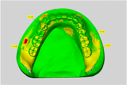 Dentistry 05 00036 i013