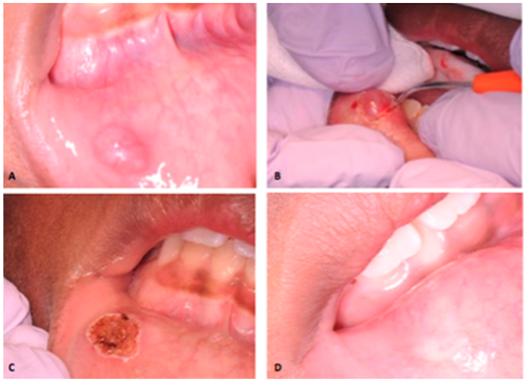 Dentistry 06 00013 g001