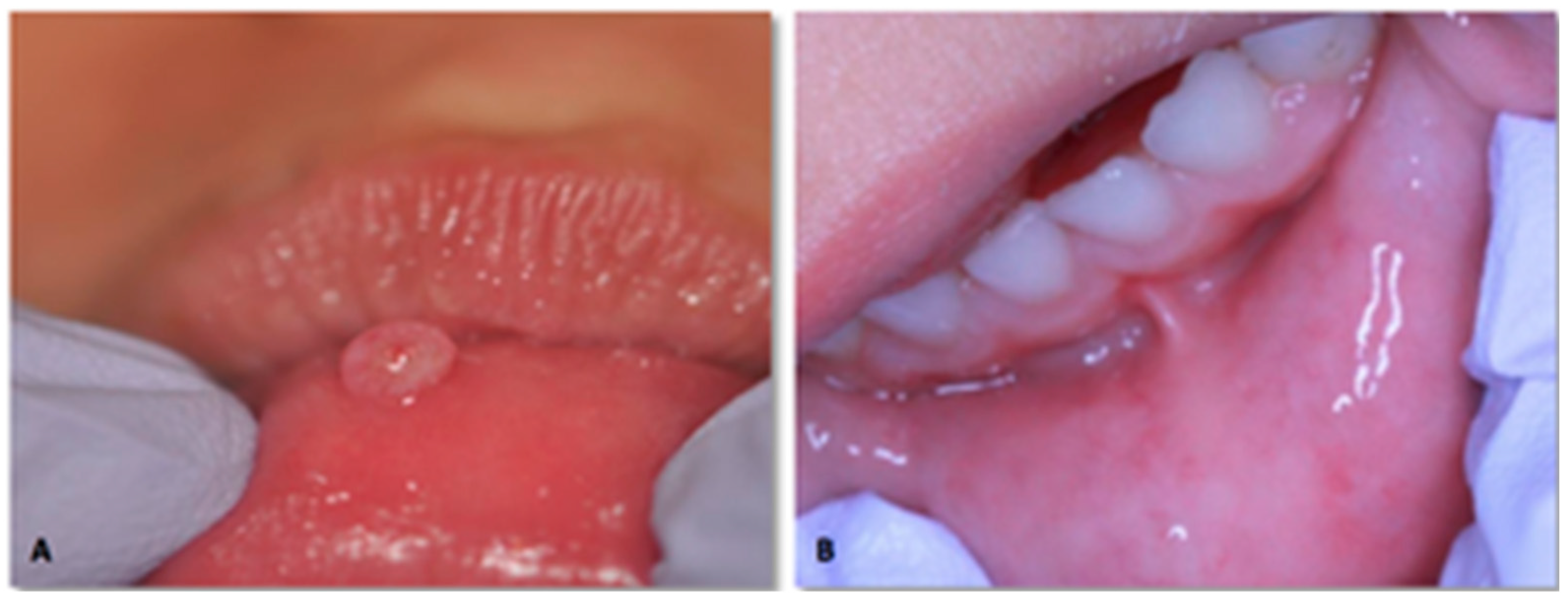 Dentistry 06 00013 g003