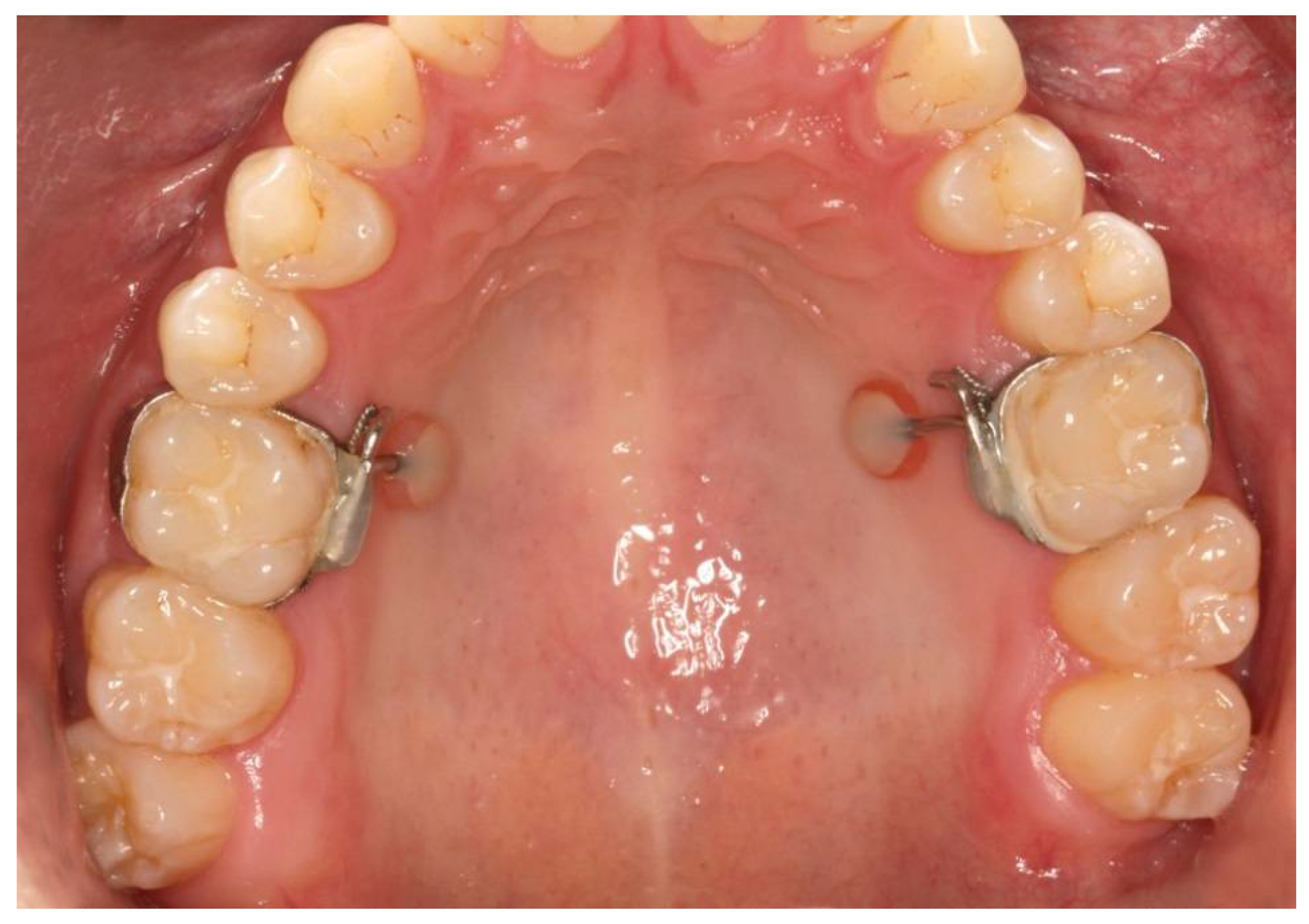 Dentistry 06 00020 g001