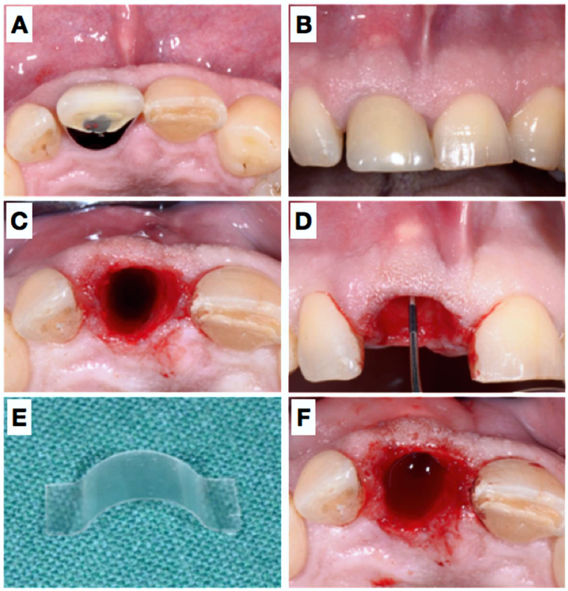 Dentistry 06 00021 g001