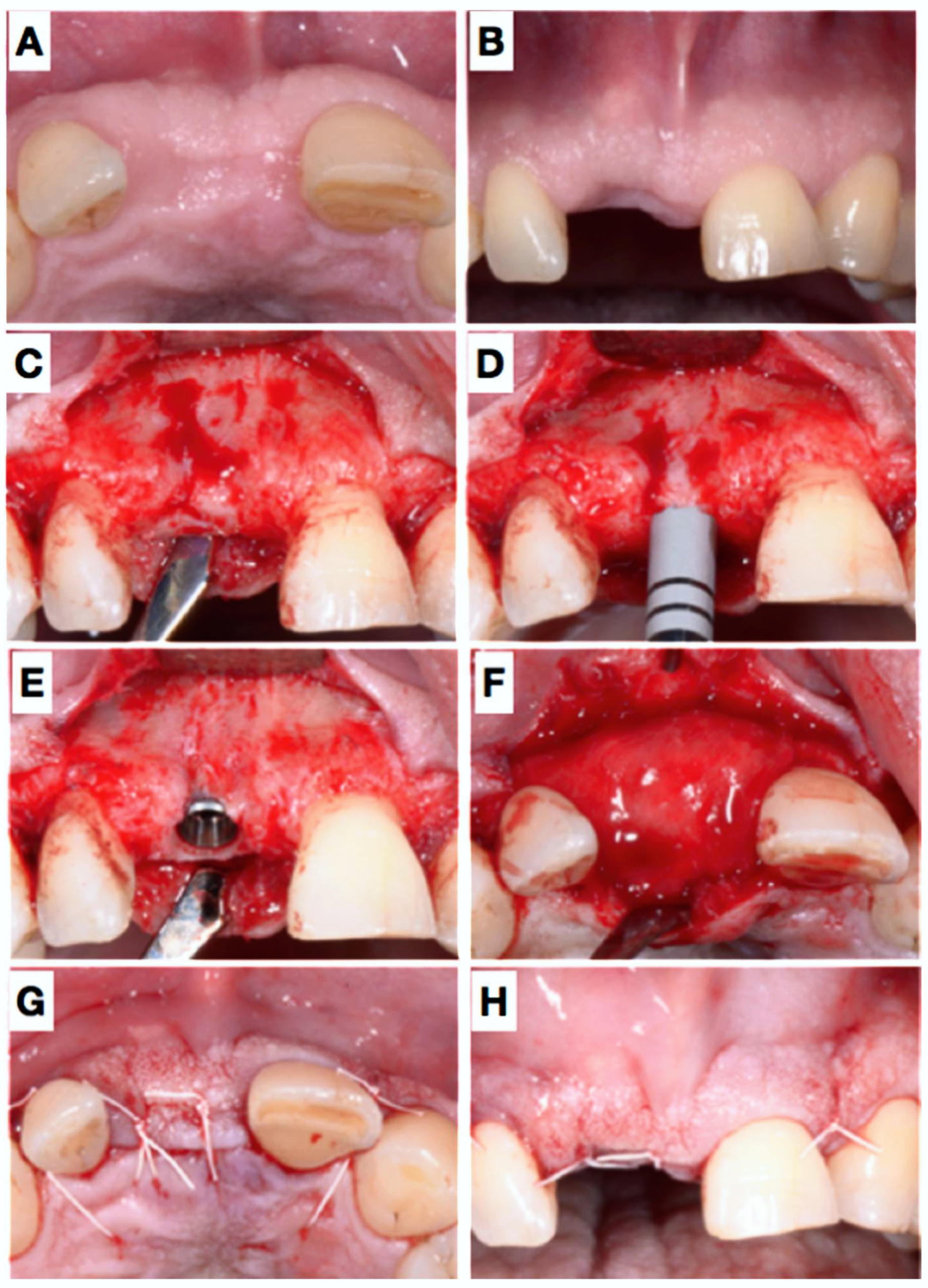 Dentistry 06 00021 g003