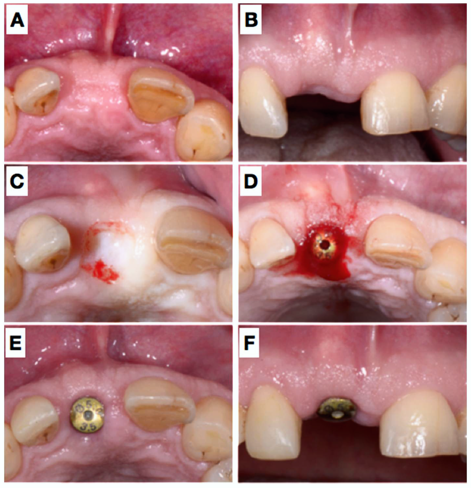 Dentistry 06 00021 g004
