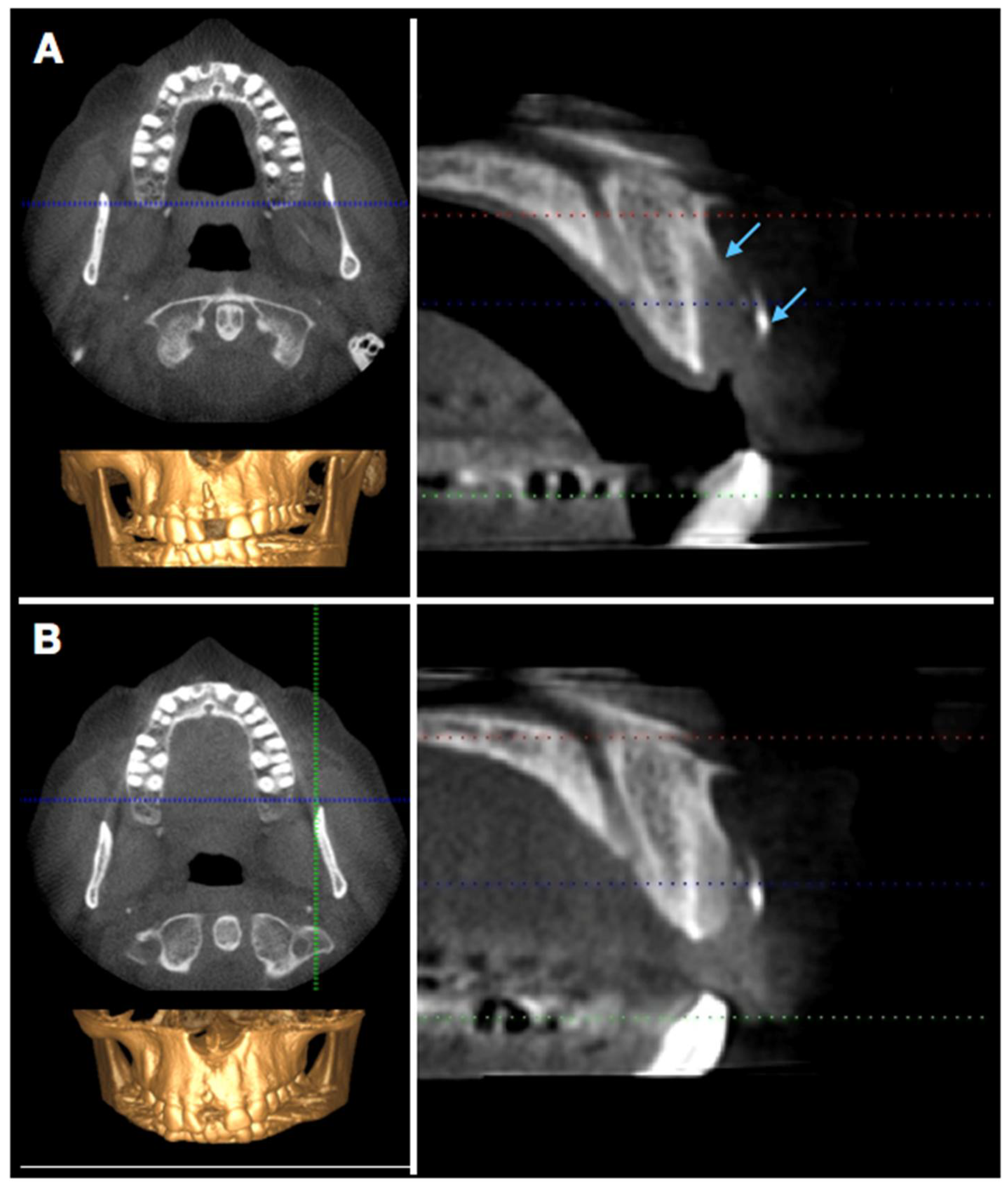 Dentistry 06 00021 g006