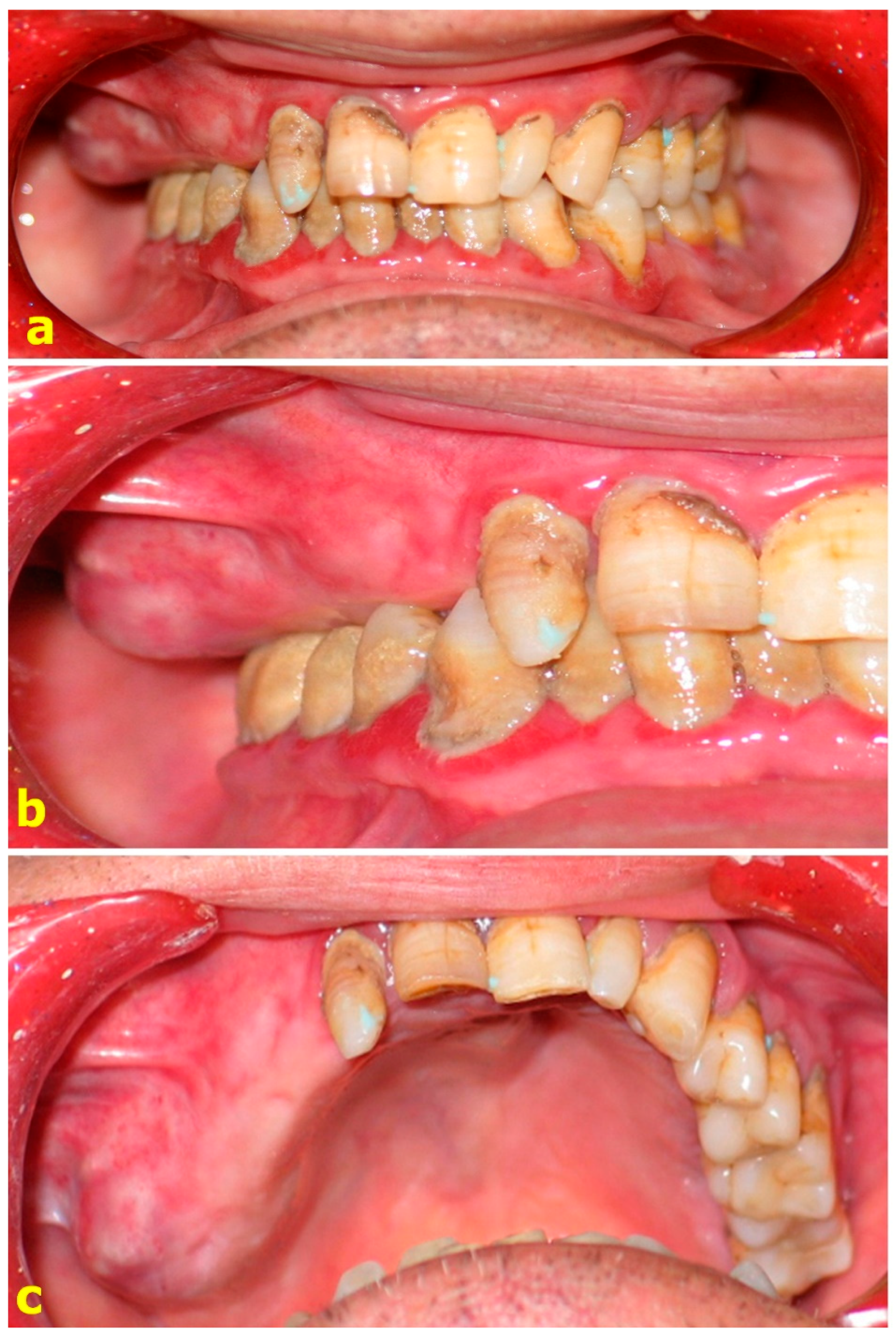 Dentistry 06 00022 g001