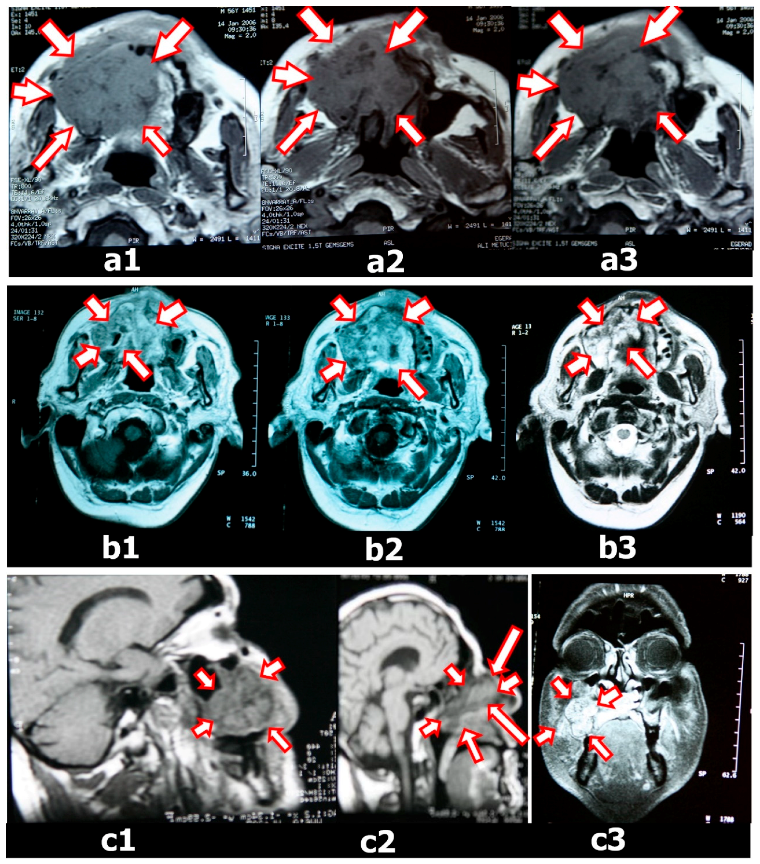 Dentistry 06 00022 g002