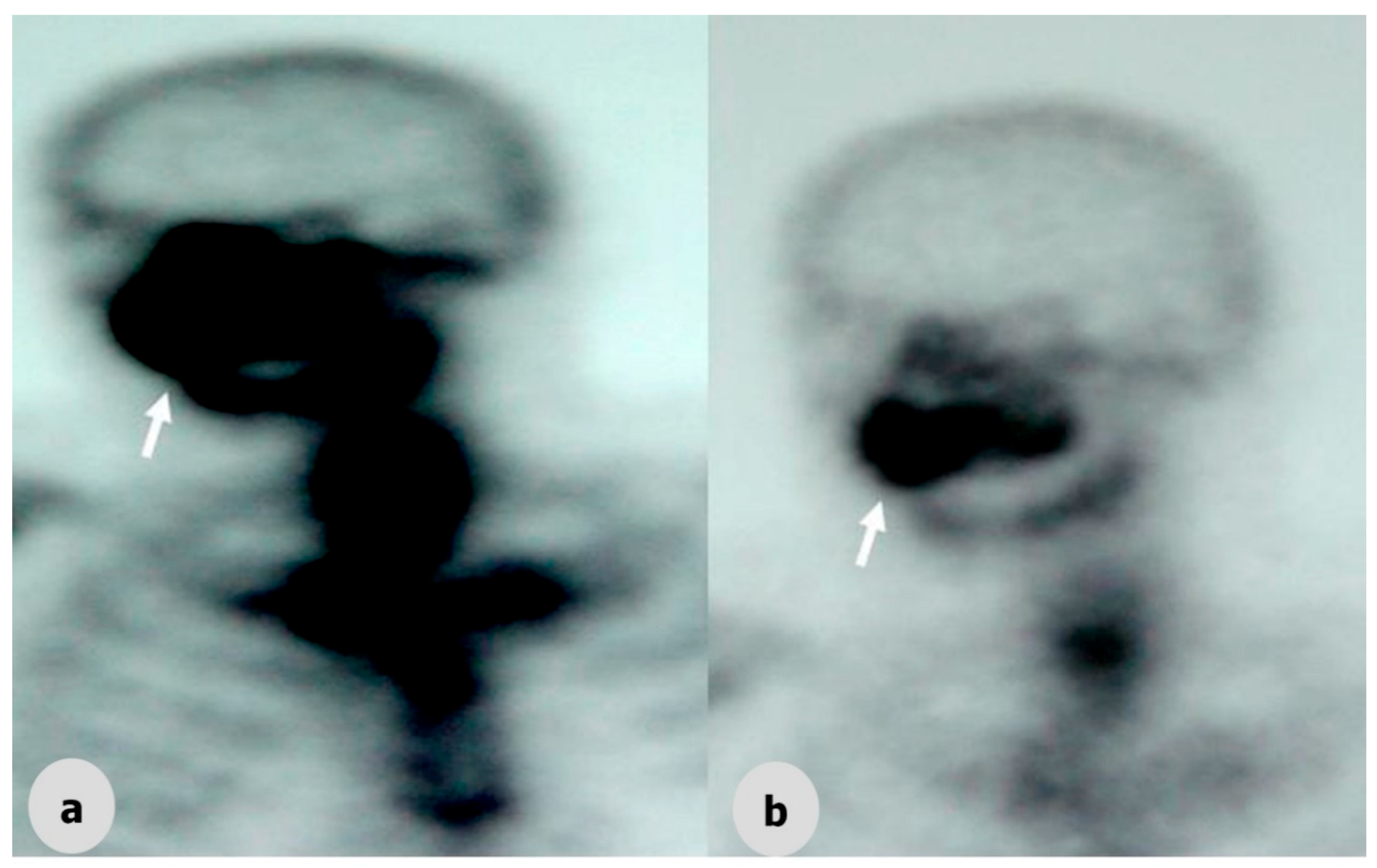 Dentistry 06 00022 g003