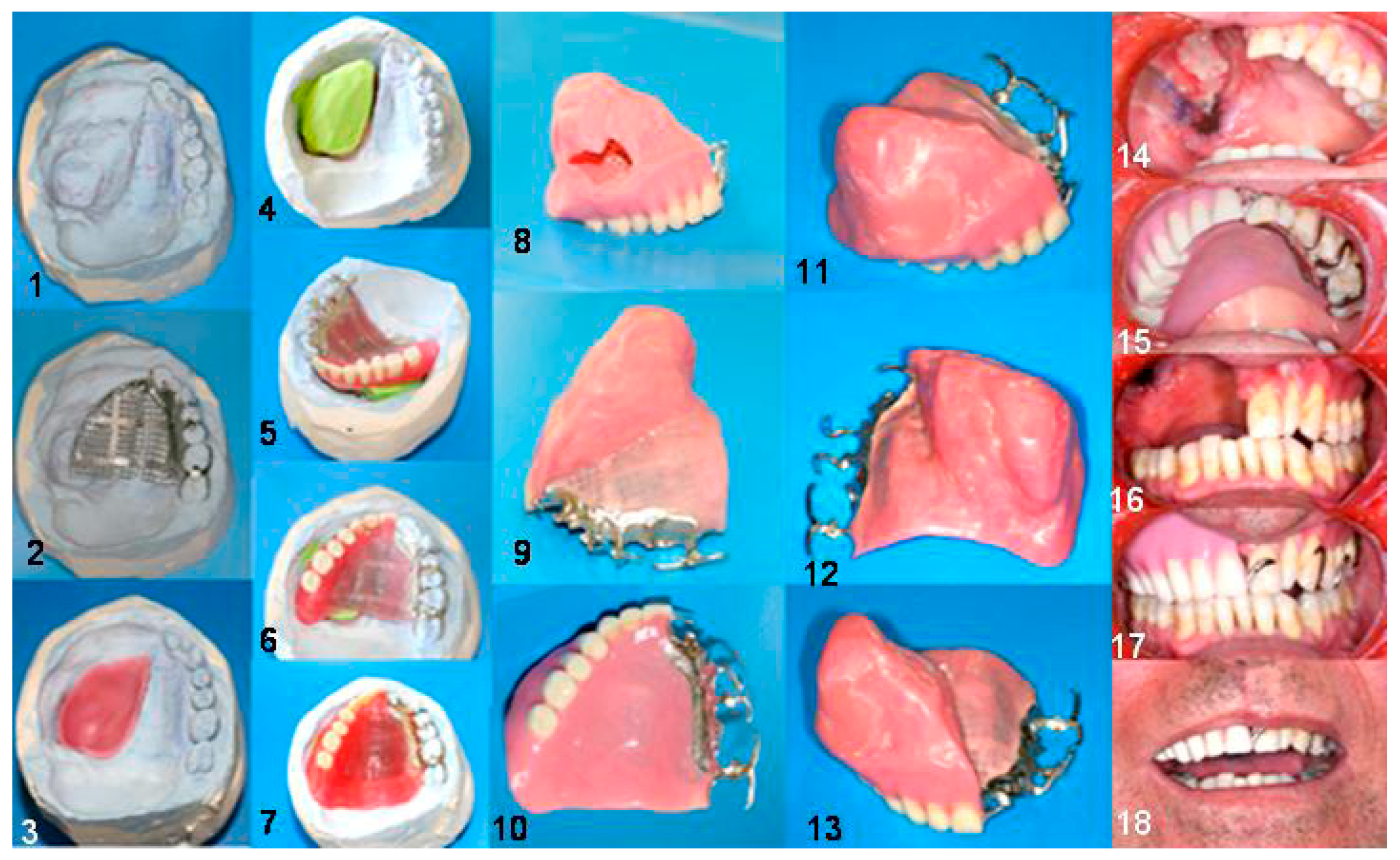 Dentistry 06 00022 g006