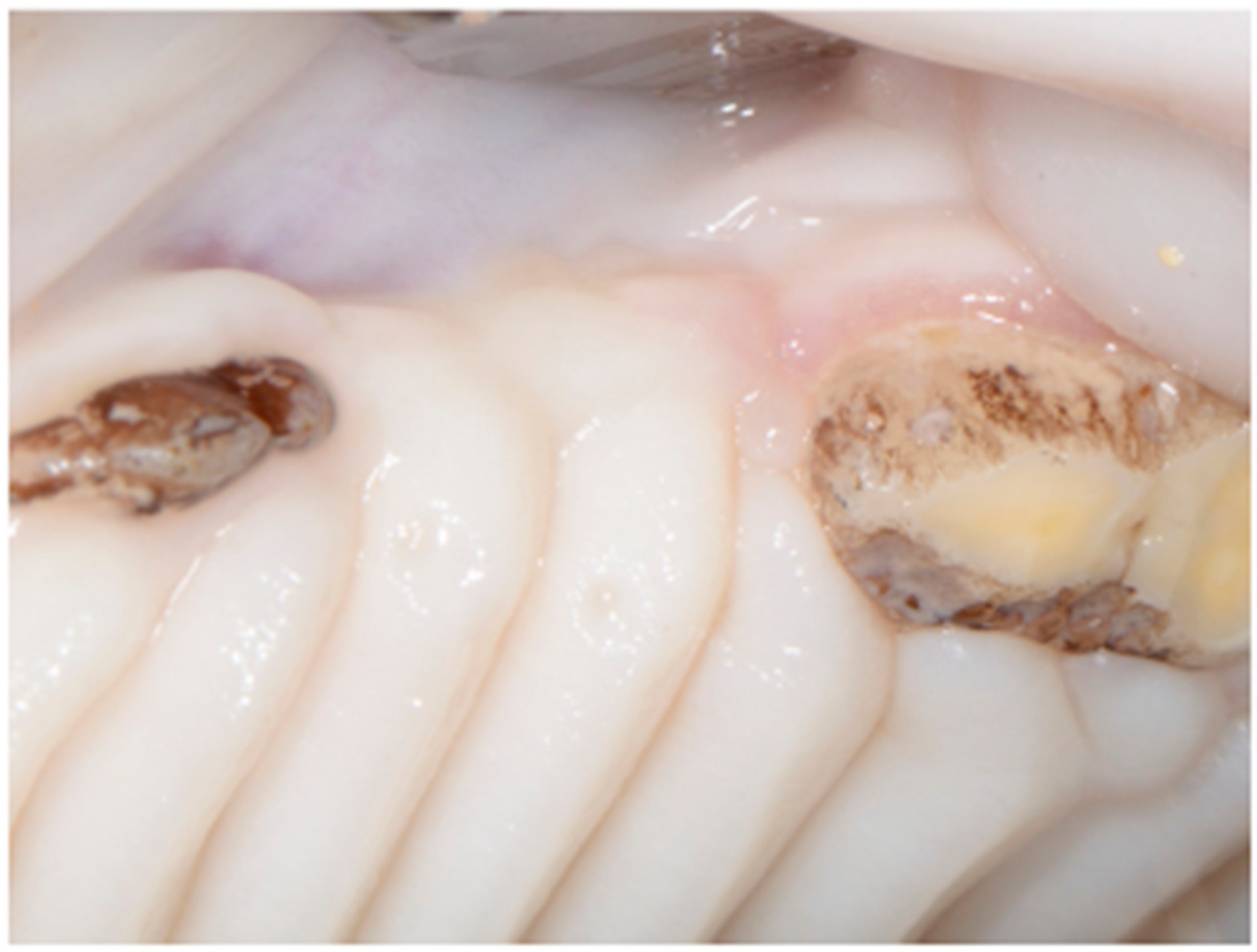 Dentistry 06 00027 g003