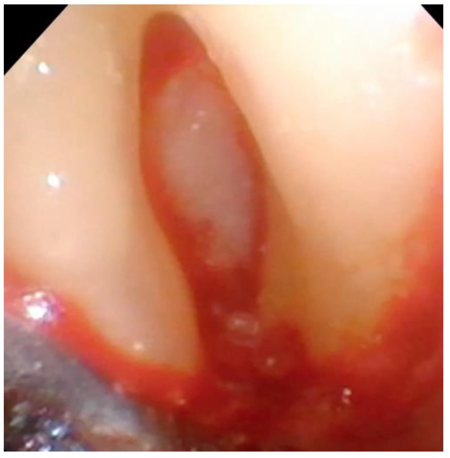 Dentistry 06 00030 g004