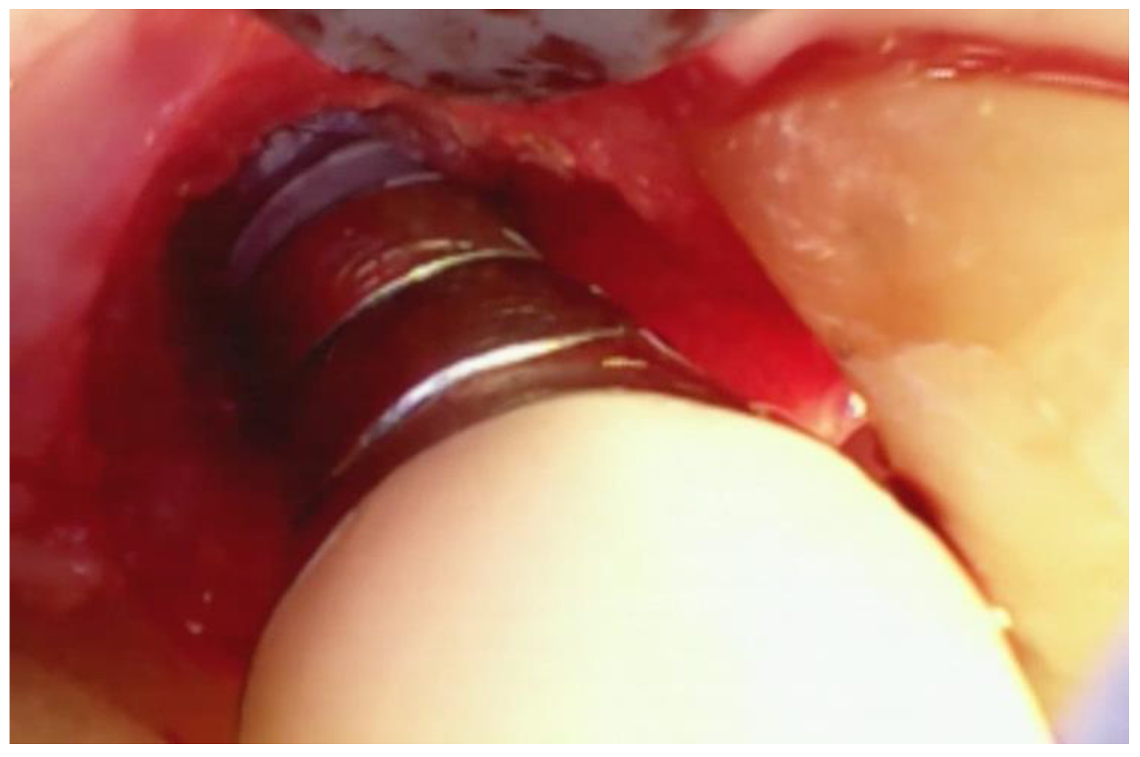 Dentistry 06 00030 g008