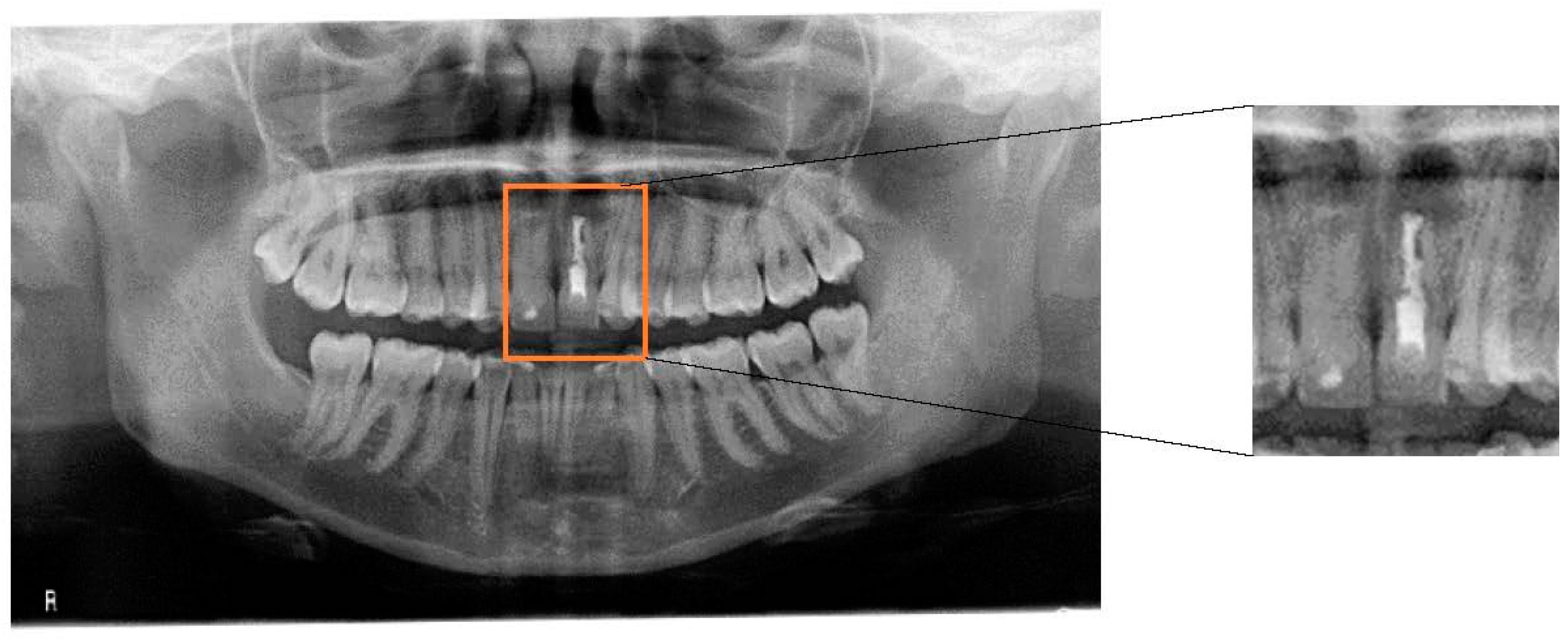 Dentistry 06 00033 g001