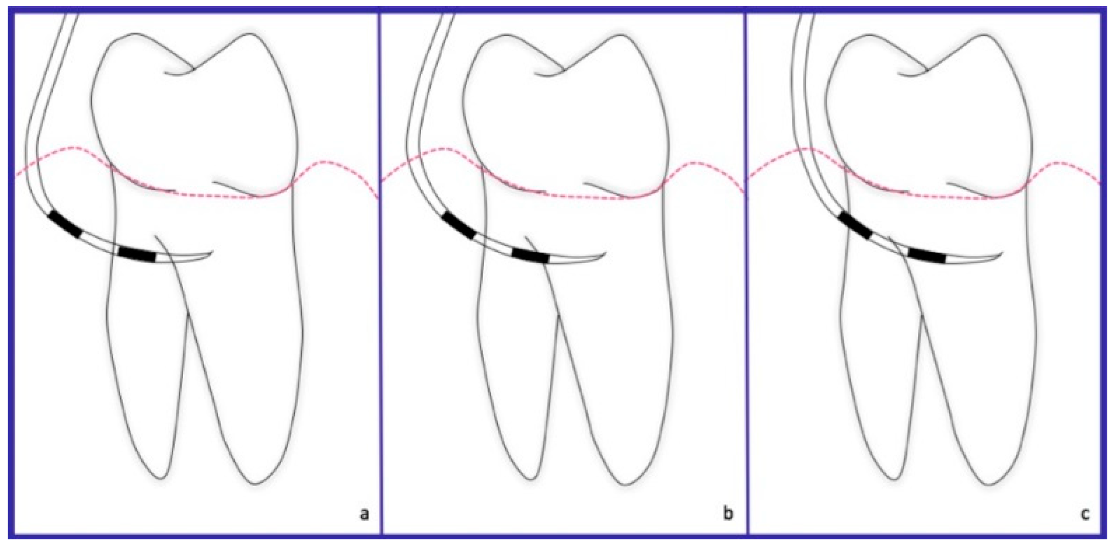 Dentistry 06 00034 g001 Dentistry 06 00034 g001